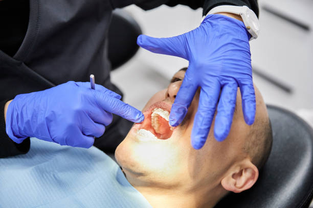 Best Emergency Treatment for Dental Infections or Abscesses in Plandome, NY